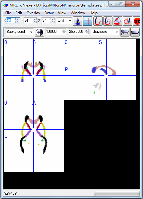 MRIcroN英文<a href=https://www.officeba.com.cn/tag/lvseban/ target=_blank class=infotextkey>绿色版</a>(医学影像分析工具)